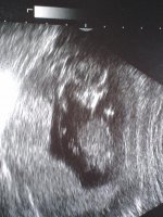 12weekultrasound.jpg