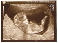 12weekscan.jpg