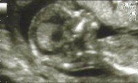 babyface.jpg