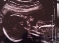 BabyM19W2.jpeg