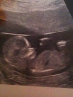 13 week scan.jpg