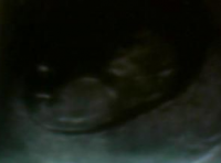 baby 11 weeks.png
