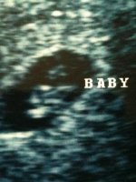 baby scan - rotated.jpg
