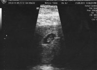 Baby1.jpg