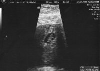 Baby2.jpg