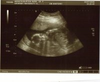 20 week scan pic 2 xxxx.jpg