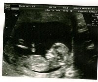 Baby 12 weeks.jpg