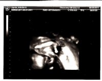 3dUS23w4d.hand.jpg