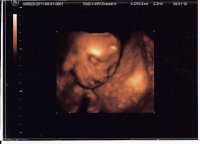 3dUS23w4d.face.jpg