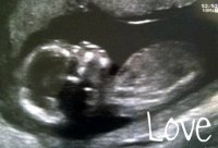 ultrasound 2 Baby #2 - 2.jpg