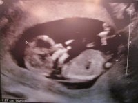 14 weeks 002.jpg