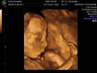 Scarlet 19 weeks.jpg