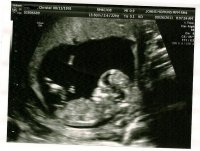 Baby 12 weeks#2.jpg