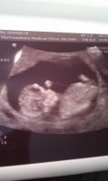 BabyV 1.jpg