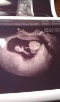 BabyV 3.jpg