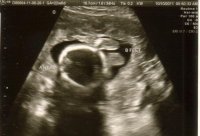 twins 22 wks pic1.jpg