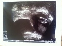 14 week gender.jpg