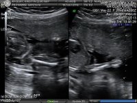 21cweek0030.jpg