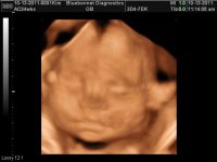 BABY 24WKS_16.jpg
