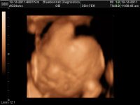 BABY 24WKS_36.jpg