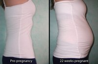 belly_beforeafter22.jpg