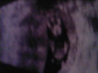SP_A0100.jpg