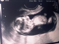 cupcake 2 at 12 weeks.jpg