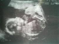 baby at 20 weeks.jpg