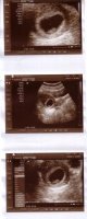 ultrasound18oct2011.jpg