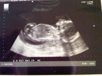 20 week scan - full pic.jpg
