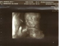 22weekface2.JPG