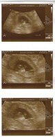 Bean1-3.jpg