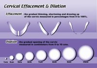 Effacement2.jpg