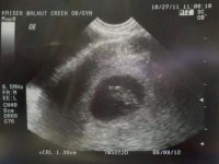 ultrasound 7w6d oct27 (2).jpg