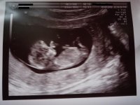 12 week scan resized2.JPG