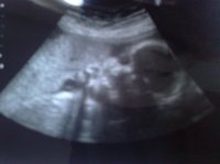 04082009655.jpg