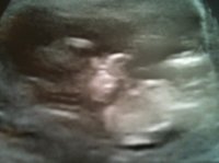 12 wk Scan.jpg