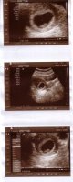 ultrasound18oct2011.jpg