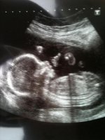 Baby Boy Pritchard 20 wks 1 day.jpg