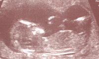 scan0015.jpg