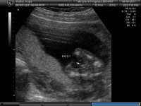 BABY BOY_15.jpg