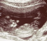 12 weeks us1.jpg