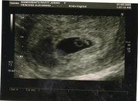 kaiden Leigh (right) xx.jpg