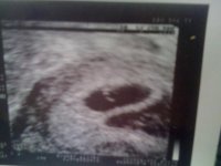 baby boo boo's xx.jpg