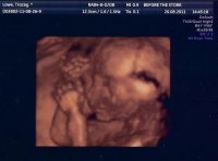 22 weeks scan edit.jpg
