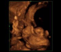 28.1weeks.jpg