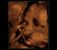 28.1weeks2.jpg