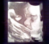 28.1weeks3.jpg