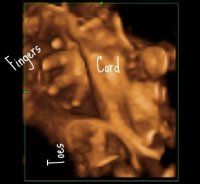 28.1weeks4.jpg