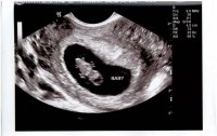 Baby at 7w4d.jpg